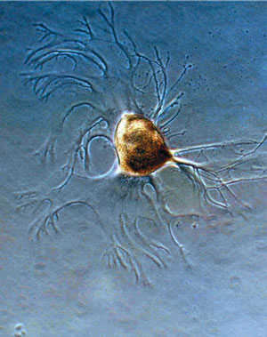 Microphotograph of an individual cultured Aplysia neuron