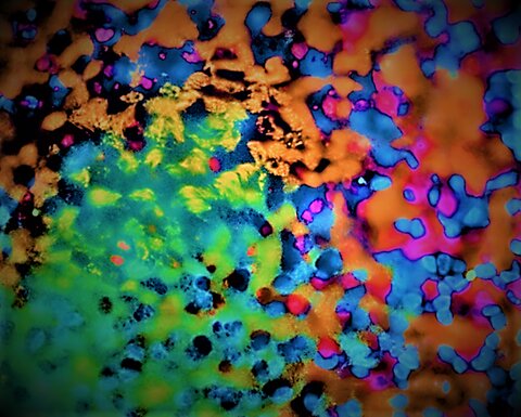 Processed, confocal fluorescence image showing human lung differentiation. 