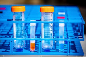 Four vials used for collecting COVID-19 saliva samples sit upright in a tray