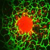 A green and red image showing how individual cells invade away from a central tumor spheroid and into the surrounding vascularized microenvironment. Tumor cells are shown in red and vasculature is shown in green.